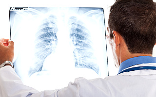 COVID-19 najbardziej zagraża osobom z chorobami oddechowymi. Narażeni są zwłaszcza palacze z chorobą płuc